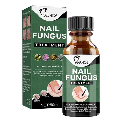 Nail Fungus Treatment